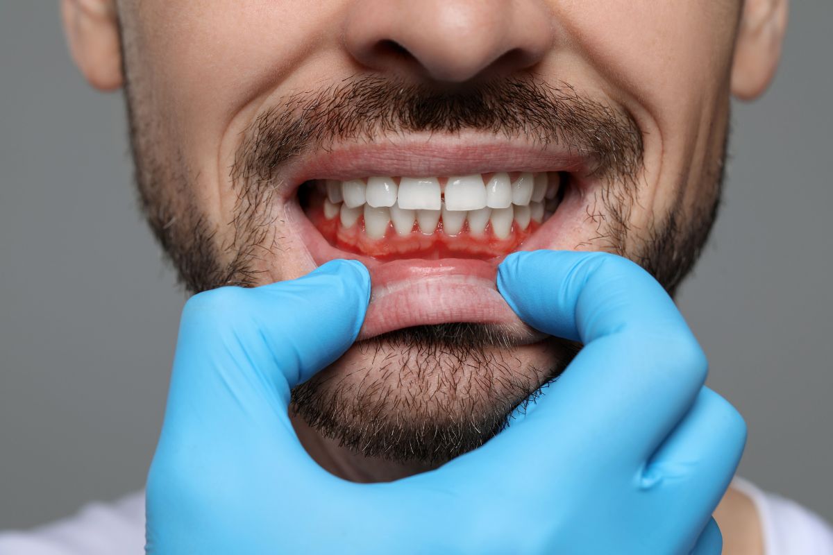 Gum Disease Treatment Dallas TX