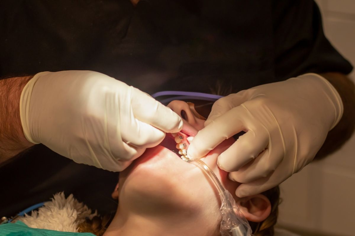 Orthodontic Treatment in Dallas
