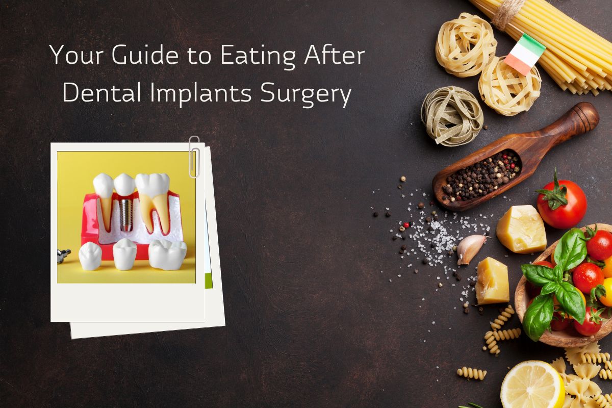 Dental implants Dallas