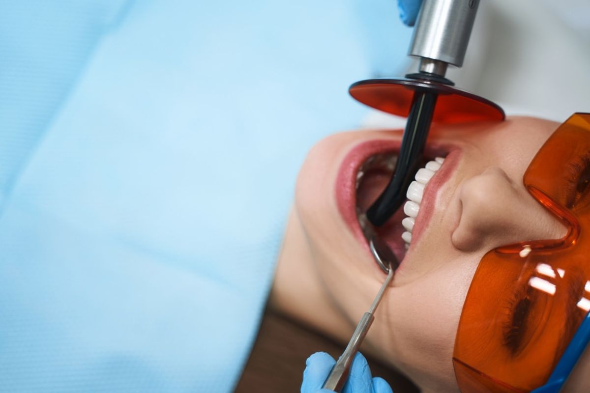 Root Canal Therapy in Dallas