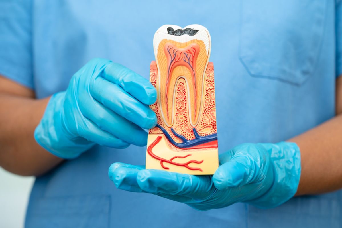 Root Canal Treatment in Dallas