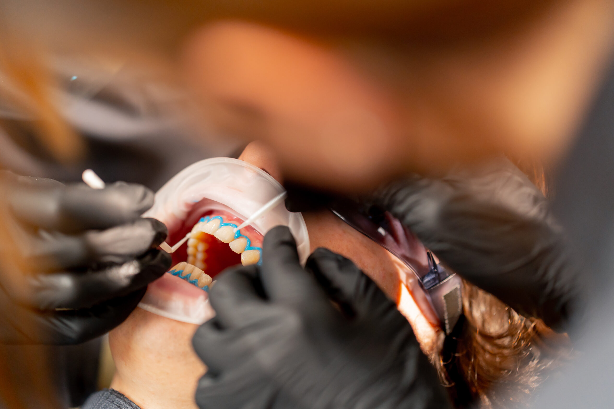 Dentist in black gloves examining patient's teeth during dental examination